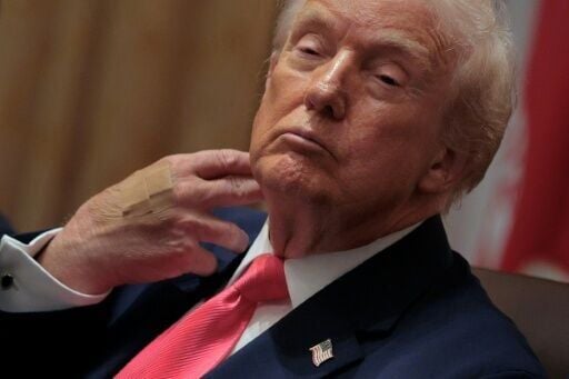 Trump clarifies health scan details, denies dozing off in meetings